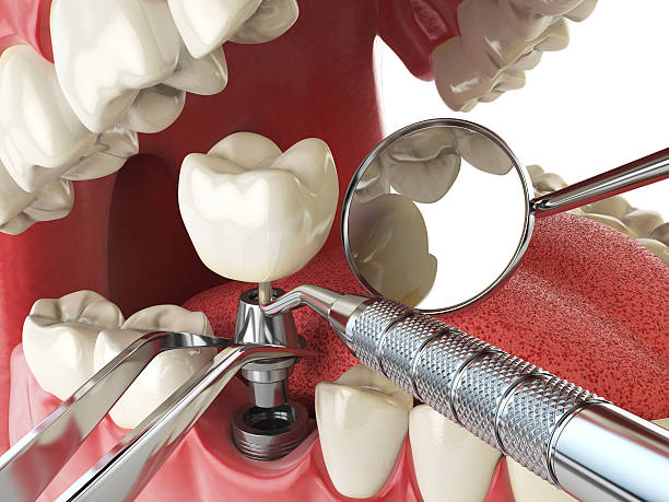 Best Emergency Denture Repair in Carlin, NV
